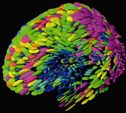 Composite image of brain MRIs
