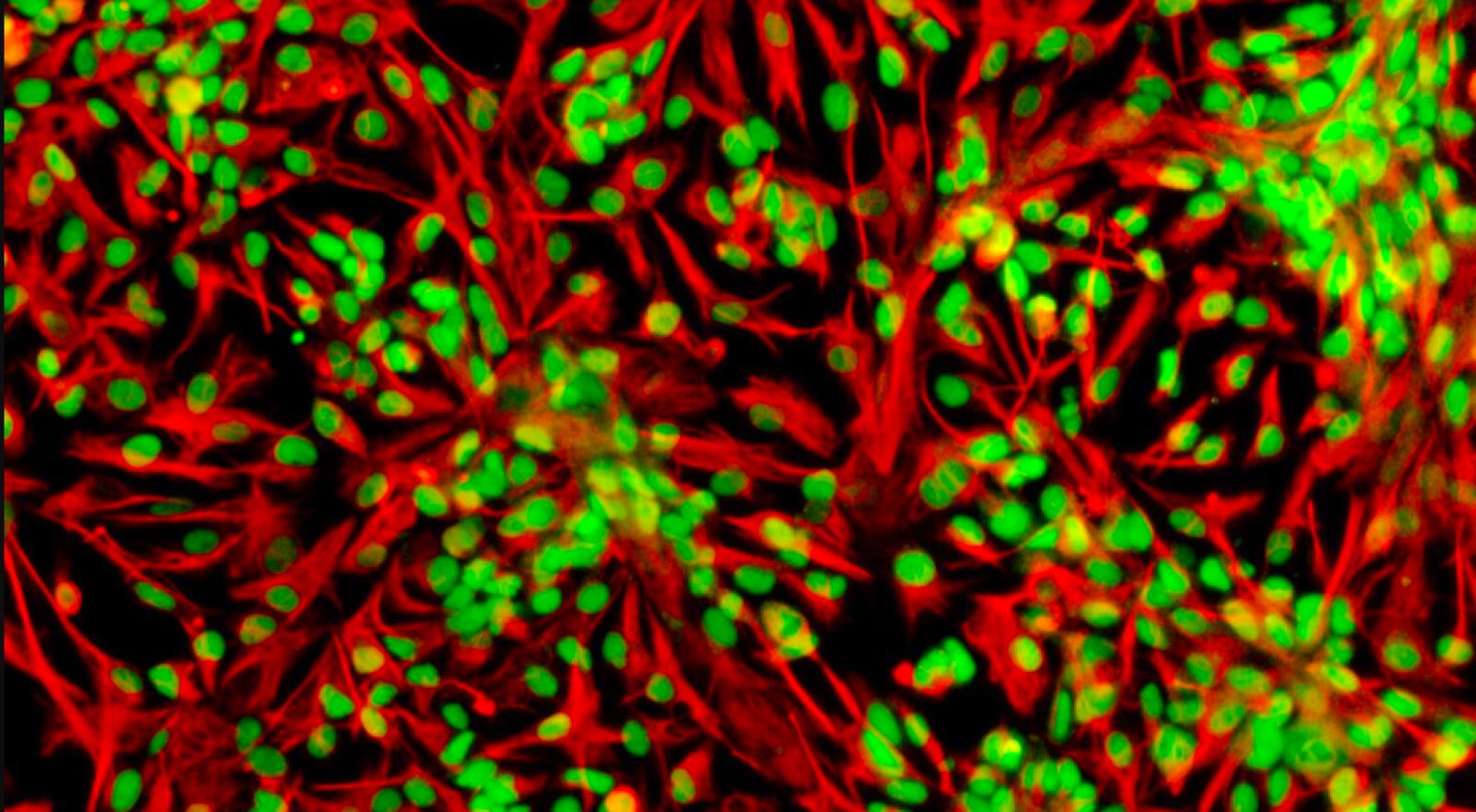 Immagine al microscopio di cellule staminali neurali umane, marcate per la proteina Sox2 (in verde, contenuta all'interno del nucleo) e la proteina vimentina (in rosso, proteina strutturale del corpo della cellula)