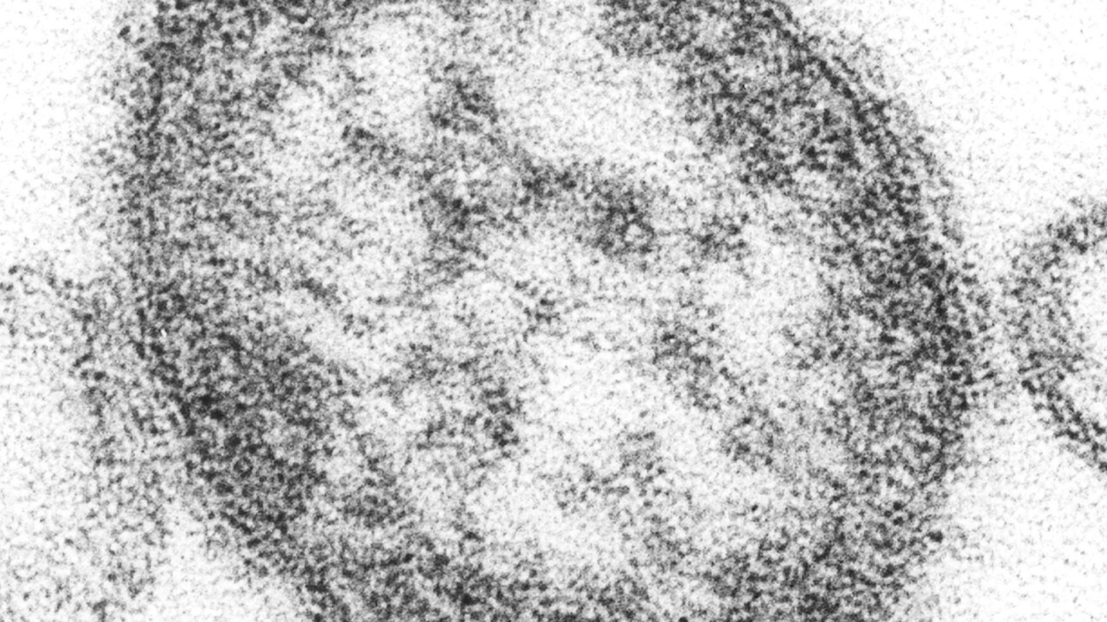 virus del morbillo al microscopio elettronico