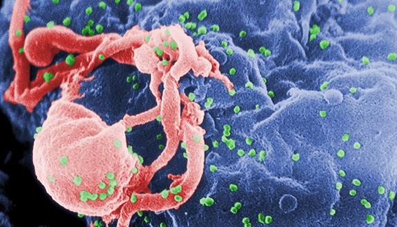 Scanning electron micrograph of HIV-1 budding