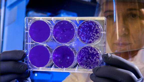 Una ricercatrice osserva in controluce alcune piastre di Petri in un laboratorio scientifico