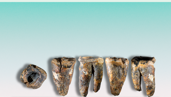 denti di neanderthal