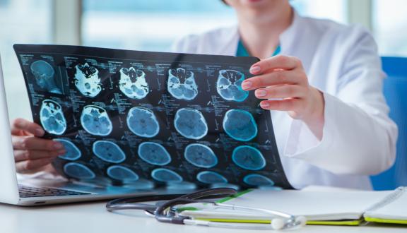 una medica analizza degli esami di imaging