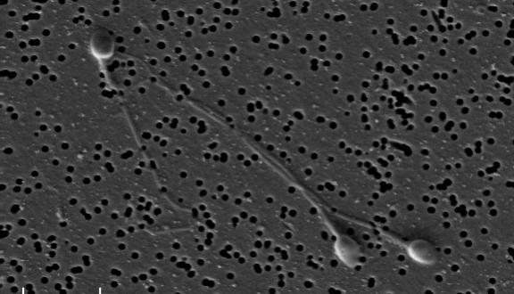 spermatozoi